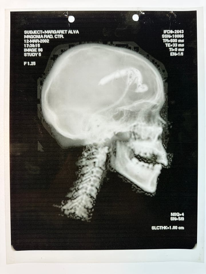 THE SHAN X-RAY PROP